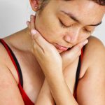 Dermatology Specialists Singapore, Angeline Yong Dermatology