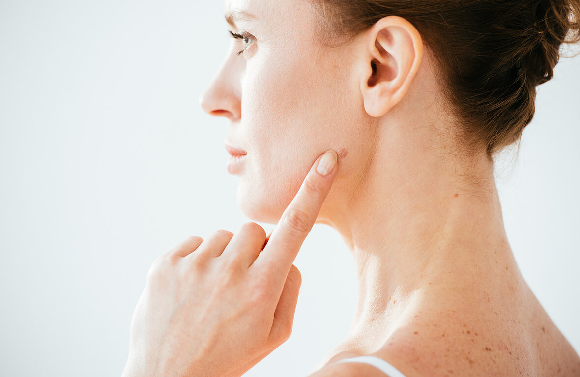 Dermatology Clinic, Skin Dermatologist Singapore