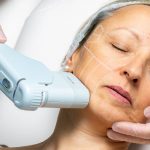 Dermatology Clinic, FUE Hair Transplant