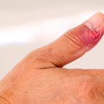 Dermatology Clinic, Dermatology Clinic Singapore