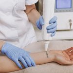 Dermatologist Singapore, Singapore Pico Laser Tattoo Removal