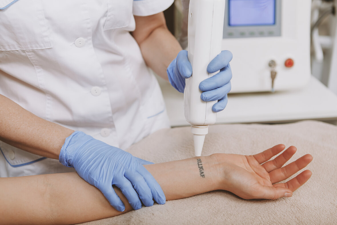 Dermatologist Singapore, Singapore Pico Laser Tattoo Removal
