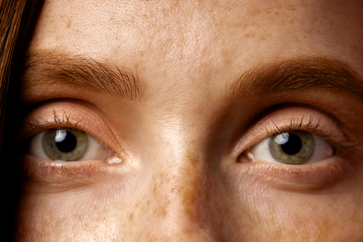 Dermatologist Singapore, Dermatologic Clinic Singapore