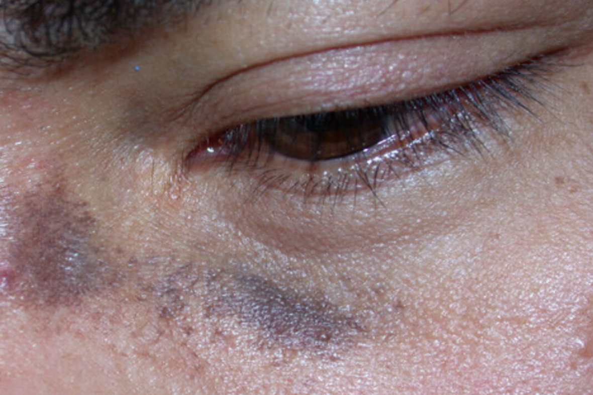 Dermatologist Singapore, Dermatologic Clinic Singapore