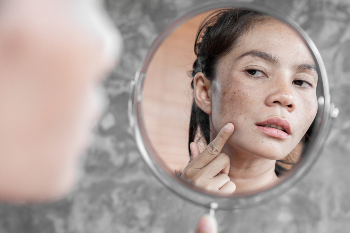 PicoWay Laser, PicoWay Laser Singapore