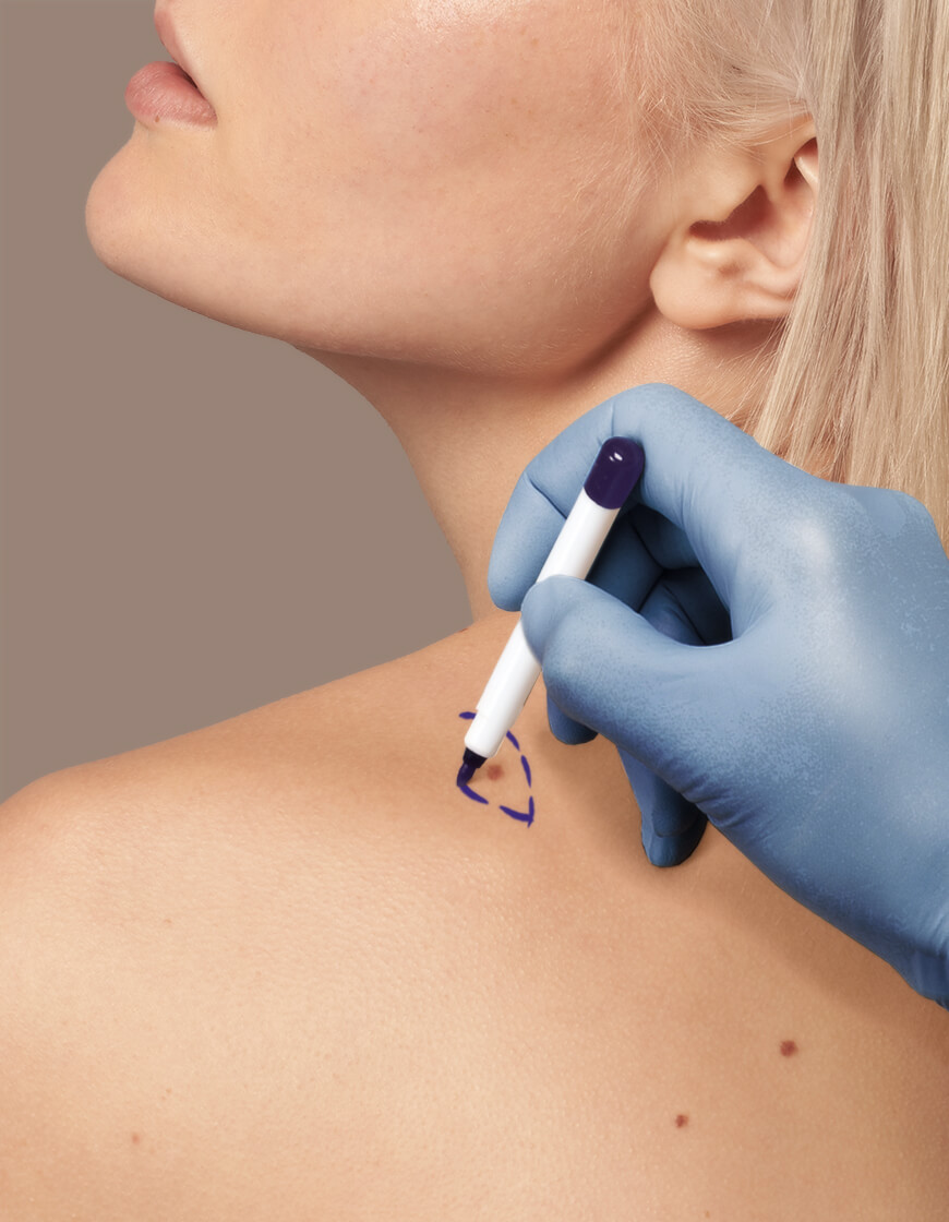 Dermatology Clinic Singapore